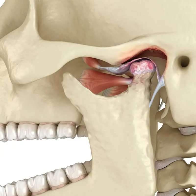 tmj-image-800x800-1 (1)