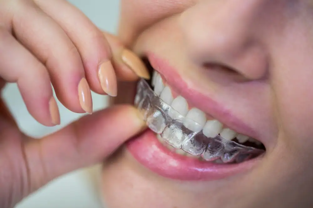 woman-wearing-orthodontic-silicone-invisible-braces